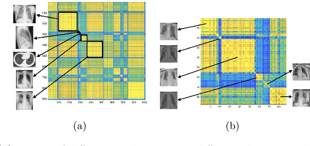 Figure 3 for Community Detection in Medical Image Datasets: Using Wavelets and Spectral Methods