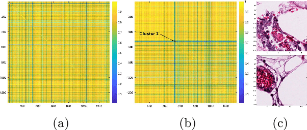 Figure 4 for Community Detection in Medical Image Datasets: Using Wavelets and Spectral Methods