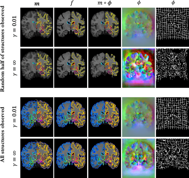 Figure 2 for VoxelMorph: A Learning Framework for Deformable Medical Image Registration