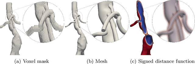 Figure 1 for Going Off-Grid: Continuous Implicit Neural Representations for 3D Vascular Modeling