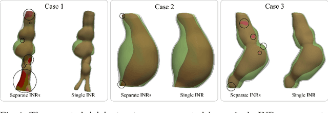 Figure 4 for Going Off-Grid: Continuous Implicit Neural Representations for 3D Vascular Modeling