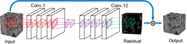 Figure 3 for CT-image Super Resolution Using 3D Convolutional Neural Network