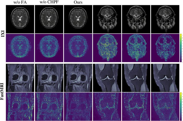 Figure 2 for Flexible Alignment Super-Resolution Network for Multi-Contrast MRI