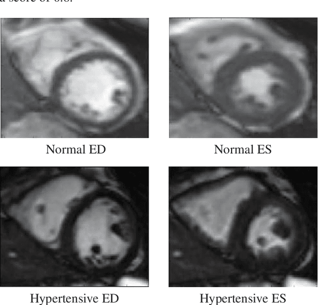 Figure 3 for A radiomics approach to analyze cardiac alterations in hypertension