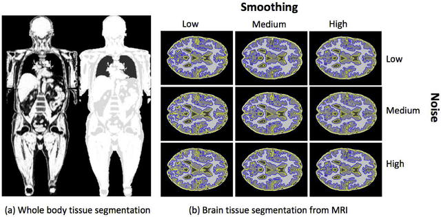 Figure 2 for A Novel Extension to Fuzzy Connectivity for Body Composition Analysis: Applications in Thigh, Brain, and Whole Body Tissue Segmentation
