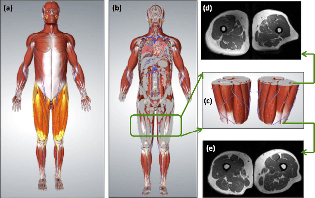 Figure 1 for A Novel Extension to Fuzzy Connectivity for Body Composition Analysis: Applications in Thigh, Brain, and Whole Body Tissue Segmentation