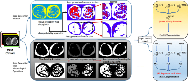 Figure 4 for A Novel Extension to Fuzzy Connectivity for Body Composition Analysis: Applications in Thigh, Brain, and Whole Body Tissue Segmentation