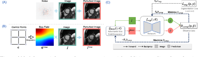 Figure 1 for Realistic Adversarial Data Augmentation for MR Image Segmentation