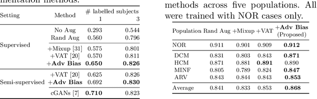 Figure 2 for Realistic Adversarial Data Augmentation for MR Image Segmentation