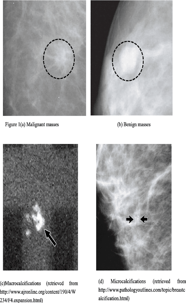 Figure 1 for Improving Specificity in Mammography Using Cross-correlation between Wavelet and Fourier Transform