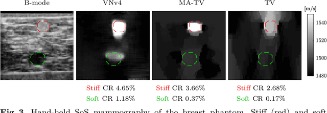 Figure 3 for Image Reconstruction via Variational Network for Real-Time Hand-Held Sound-Speed Imaging