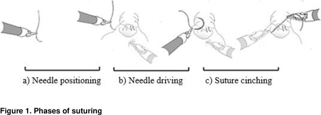 Figure 1 for Deep learning-based computer vision to recognize and classify suturing gestures in robot-assisted surgery