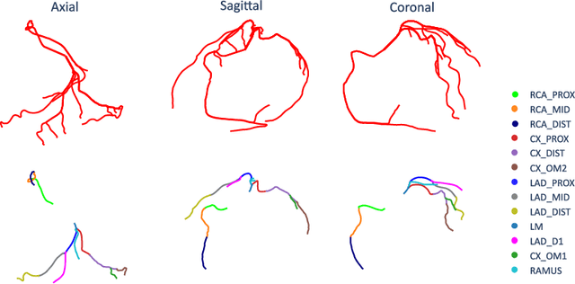 Figure 3 for CAD-RADS Scoring using Deep Learning and Task-Specific Centerline Labeling