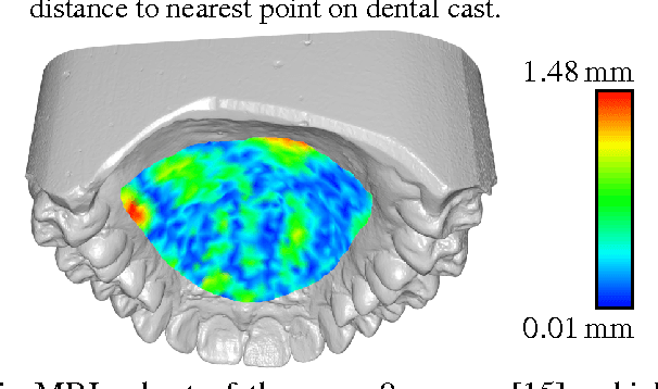 Figure 3 for A statistical shape space model of the palate surface trained on 3D MRI scans of the vocal tract