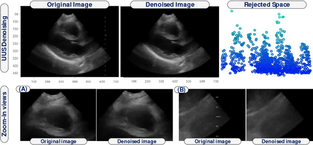 Figure 4 for Robust Cardiac Motion Estimation using Ultrafast Ultrasound Data: A Low-Rank-Topology-Preserving Approach