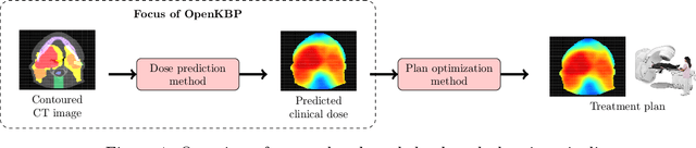 Figure 1 for OpenKBP: The open-access knowledge-based planning grand challenge