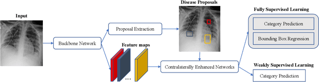 Figure 4 for Contralaterally Enhanced Networks for Thoracic Disease Detection