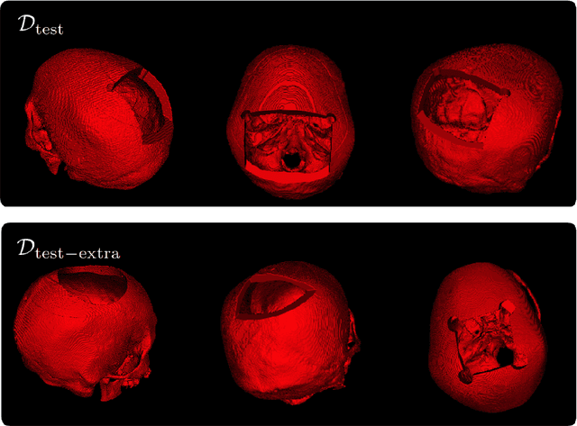 Figure 1 for Cranial Implant Design via Virtual Craniectomy with Shape Priors