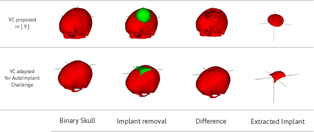 Figure 3 for Cranial Implant Design via Virtual Craniectomy with Shape Priors