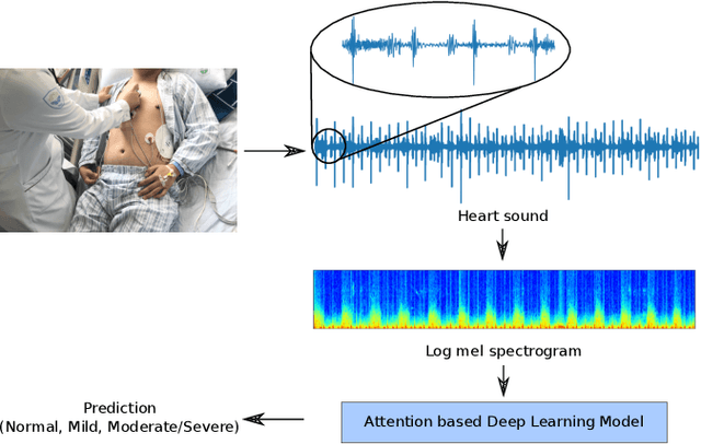 Figure 1 for Deep Attention-based Representation Learning for Heart Sound Classification