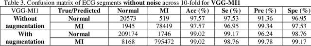 Figure 4 for A Novel Deep Transfer Learning Method for Detection of Myocardial Infarction