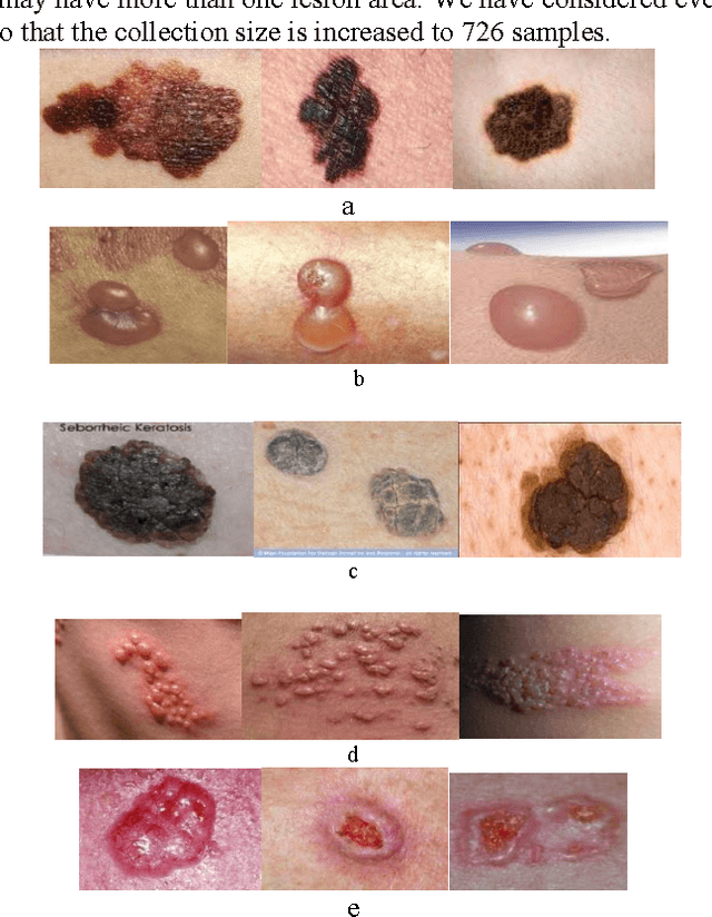 Figure 1 for Segmentation and Classification of Skin Lesions for Disease Diagnosis