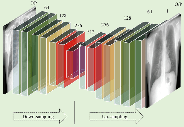 Figure 3 for A bone suppression model ensemble to improve COVID-19 detection in chest X-rays