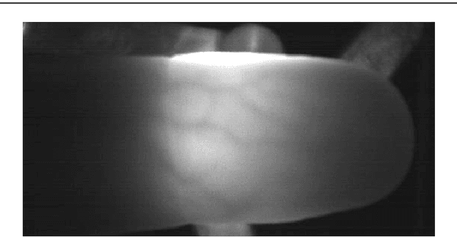 Figure 2 for Rapid, remote and low-cost finger vasculature mapping for heart rate monitoring