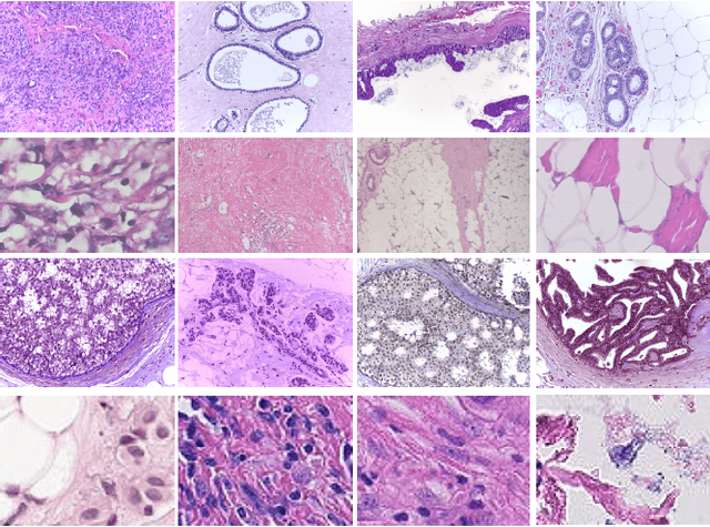 Figure 1 for Classification of Histopathological Biopsy Images Using Ensemble of Deep Learning Networks
