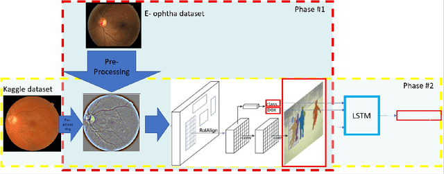 Figure 3 for DRDrV3: Complete Lesion Detection in Fundus Images Using Mask R-CNN, Transfer Learning, and LSTM