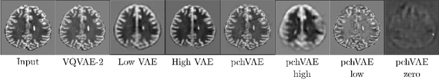 Figure 3 for High- and Low-level image component decomposition using VAEs for improved reconstruction and anomaly detection