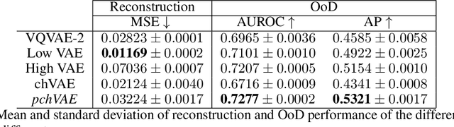 Figure 2 for High- and Low-level image component decomposition using VAEs for improved reconstruction and anomaly detection