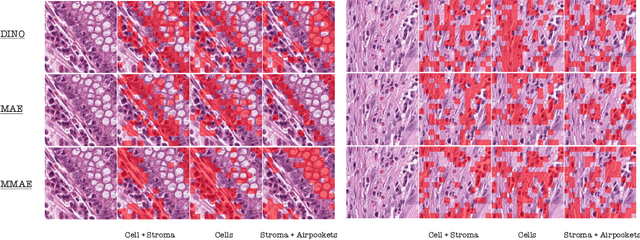 Figure 4 for Multi-modal Masked Autoencoders Learn Compositional Histopathological Representations