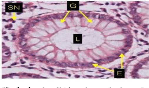 Figure 1 for Gland Segmentation in Histopathology Images Using Random Forest Guided Boundary Construction