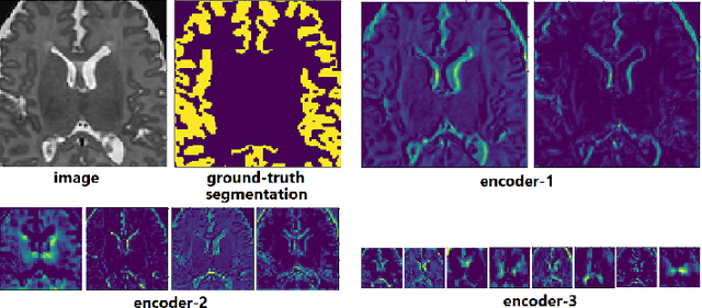 Figure 2 for Critical Assessment of Transfer Learning for Medical Image Segmentation with Fully Convolutional Neural Networks