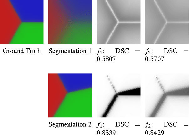 Figure 3 for Multi-Region Probabilistic Dice Similarity Coefficient using the Aitchison Distance and Bipartite Graph Matching