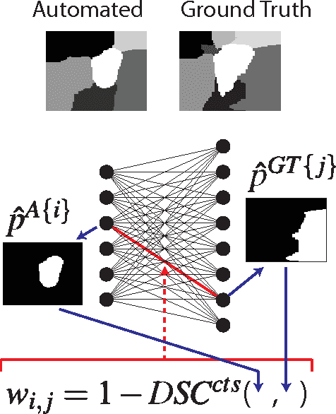 Figure 4 for Multi-Region Probabilistic Dice Similarity Coefficient using the Aitchison Distance and Bipartite Graph Matching