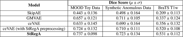 Figure 2 for StRegA: Unsupervised Anomaly Detection in Brain MRIs using a Compact Context-encoding Variational Autoencoder