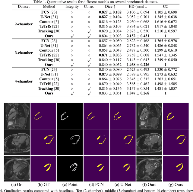 Figure 2 for Deep Statistic Shape Model for Myocardium Segmentation