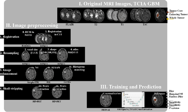 Figure 4 for Neglectable effect of brain MRI data prepreprocessing for tumor segmentation