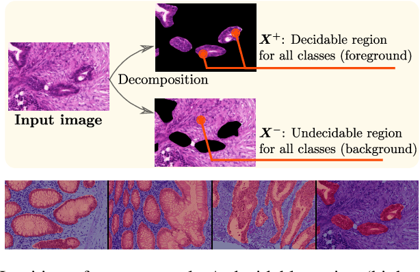 Figure 1 for Deep Interpretable Classification and Weakly-Supervised Segmentation of Histology Images via Max-Min Uncertainty