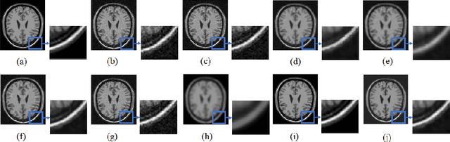 Figure 4 for An unsupervised deep learning framework for medical image denoising