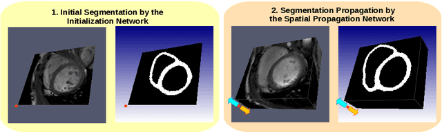 Figure 1 for 3D Consistent Biventricular Myocardial Segmentation Using Deep Learning for Mesh Generation