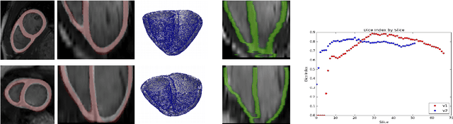 Figure 3 for 3D Consistent Biventricular Myocardial Segmentation Using Deep Learning for Mesh Generation