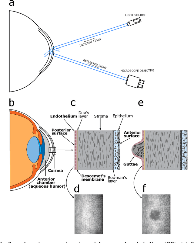Figure 1 for Corneal endothelium assessment in specular microscopy images with Fuchs' dystrophy via deep regression of signed distance maps