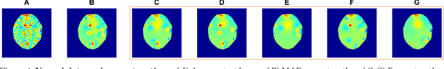 Figure 4 for Nonparametric variational inference