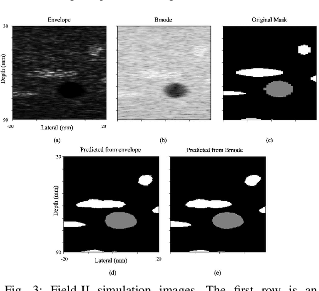 Figure 3 for Ultrasound segmentation using U-Net: learning from simulated data and testing on real data
