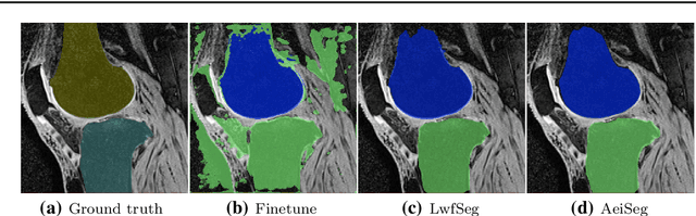 Figure 3 for Extending Pretrained Segmentation Networks with Additional Anatomical Structures