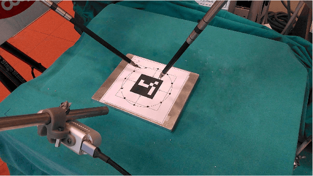 Figure 1 for Improving rigid 3D calibration for robotic surgery