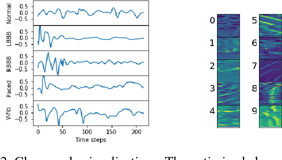 Figure 2 for Techniques for visualizing LSTMs applied to electrocardiograms